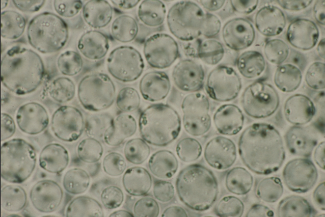 Blastocystis. Foto: Diagnostic Parasitology Laboratory, London School of Hygiene and Tropical Medicine.
